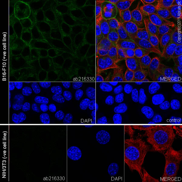 Immunocytochemistry/ Immunofluorescence - Anti-Met (c-Met) antibody [EPR22436-24] (AB216330), expandable thumbnail