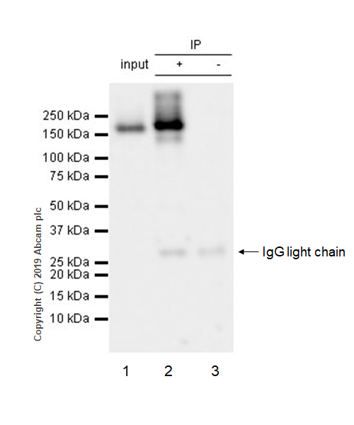 Immunoprecipitation - Anti-Met (c-Met) antibody [EPR22436-24] (AB216330), expandable thumbnail
