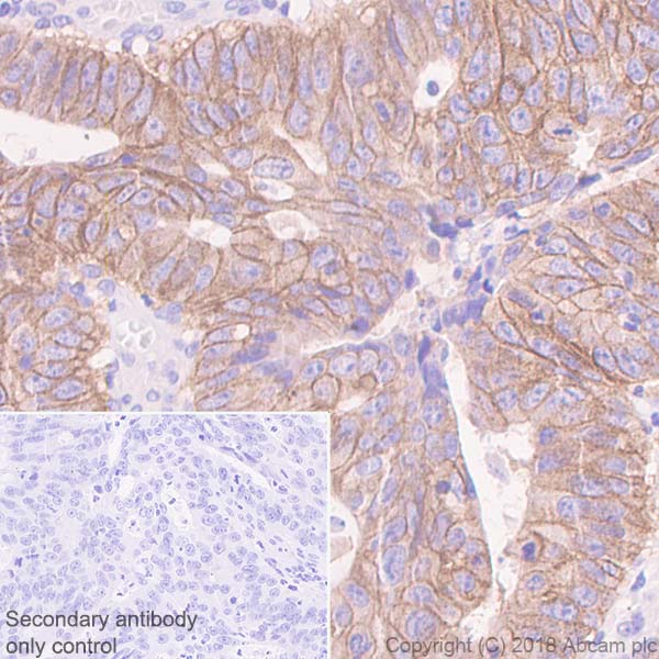 Immunohistochemistry (Formalin/PFA-fixed paraffin-embedded sections) - Anti-Met (c-Met) antibody [SP44] - BSA and Azide free (AB243930), expandable thumbnail