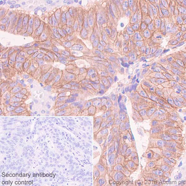Immunohistochemistry (Formalin/PFA-fixed paraffin-embedded sections) - Anti-Met (c-Met) antibody [SP44] - BSA and Azide free (AB243930)
