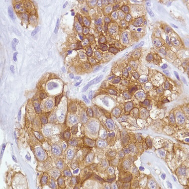 Immunohistochemistry (Formalin/PFA-fixed paraffin-embedded sections) - Anti-Met (c-Met) antibody [SP44] - BSA and Azide free (AB243930), expandable thumbnail