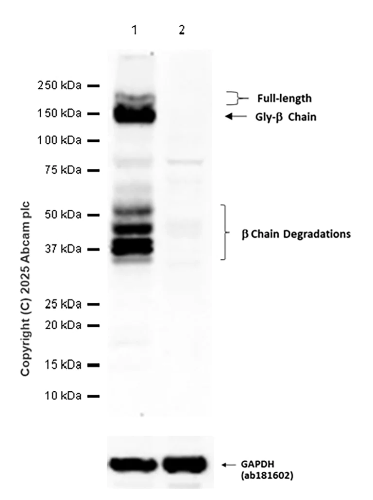 Western blot - Anti-Met (c-Met) antibody [SP44] - BSA and Azide free (AB243930)