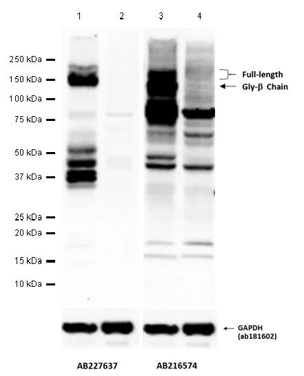 Western blot - Anti-Met (c-Met) antibody [SP44] - C-terminal (AB227637)