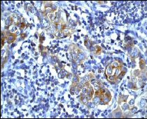 Immunohistochemistry (Formalin/PFA-fixed paraffin-embedded sections) - Anti-Met (c-Met) (phospho Y1349) antibody [EP2367Y] (AB68141)