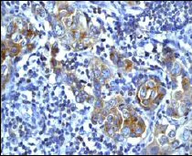 Immunohistochemistry (Formalin/PFA-fixed paraffin-embedded sections) - Anti-Met (c-Met) (phospho Y1349) antibody [EP2367Y] - BSA and Azide free (AB247359)