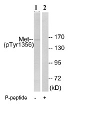 Western blot - Anti-Met (c-Met) (phospho Y1356) antibody (AB73992)