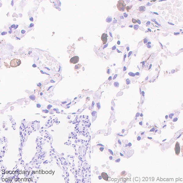 Immunohistochemistry (Formalin/PFA-fixed paraffin-embedded sections) - Metabolic Suppression of Immune Cells Panel - Human IHC (AB278179)