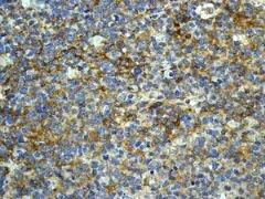 Immunohistochemistry (Formalin/PFA-fixed paraffin-embedded sections) - Metabolic Suppression of Immune Cells Panel - Human IHC (AB278179)