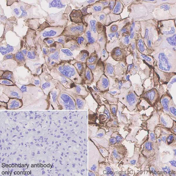 Immunohistochemistry (Formalin/PFA-fixed paraffin-embedded sections) - Metabolic Suppression of Immune Cells Panel - Human IHC (AB278179)