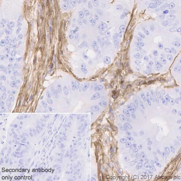 Immunohistochemistry (Formalin/PFA-fixed paraffin-embedded sections) - Metabolic Suppression of Immune Cells Panel - Human IHC (AB278179)
