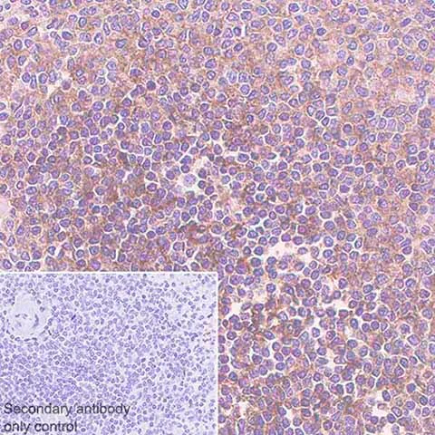 Immunohistochemistry (Formalin/PFA-fixed paraffin-embedded sections) - Metabolic Suppression of Immune Cells Panel - Human IHC (AB278179)