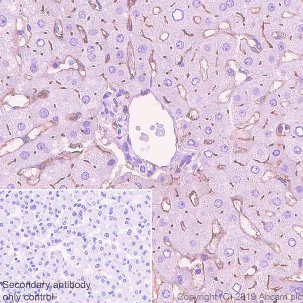 Immunohistochemistry (Formalin/PFA-fixed paraffin-embedded sections) - Metabolic Suppression of Immune Cells Panel - Human IHC (AB278179)