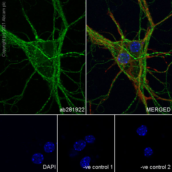 Immunocytochemistry/ Immunofluorescence - Anti-Metabotropic Glutamate Receptor 2 + 3 / MGLUR2 + MGLUR3 antibody [EPR24635-155] (ab281922), expandable thumbnail