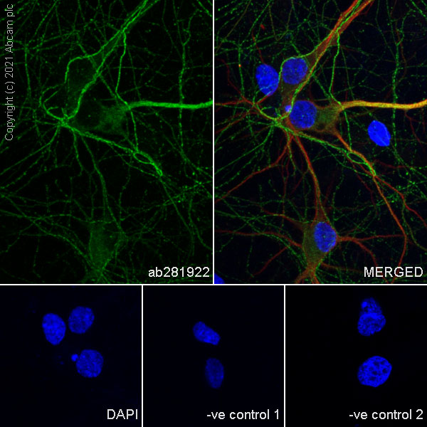 Immunocytochemistry/ Immunofluorescence - Anti-Metabotropic Glutamate Receptor 2 + 3 / MGLUR2 + MGLUR3 antibody [EPR24635-155] (ab281922), expandable thumbnail