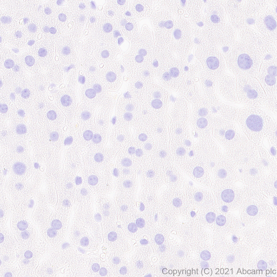 Immunohistochemistry (Formalin/PFA-fixed paraffin-embedded sections) - Anti-Metabotropic Glutamate Receptor 2 + 3 / MGLUR2 + MGLUR3 antibody [EPR24635-155] (ab281922), expandable thumbnail