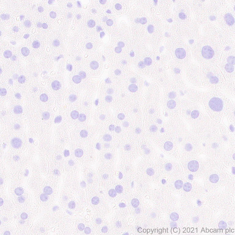 Immunohistochemistry (Formalin/PFA-fixed paraffin-embedded sections) - Anti-Metabotropic Glutamate Receptor 2 + 3 / MGLUR2 + MGLUR3 antibody [EPR24635-155] (AB281922)