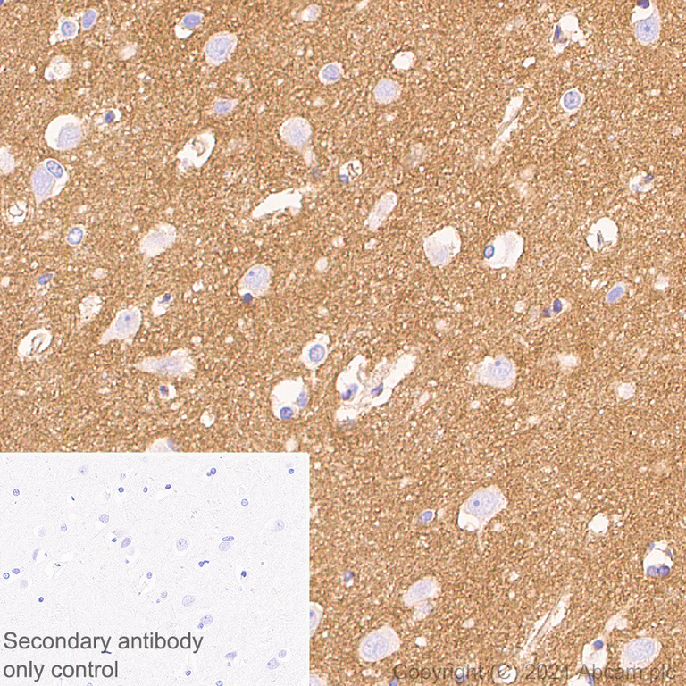 Immunohistochemistry (Formalin/PFA-fixed paraffin-embedded sections) - Anti-Metabotropic Glutamate Receptor 2 + 3 / MGLUR2 + MGLUR3 antibody [EPR24635-155] (AB281922)