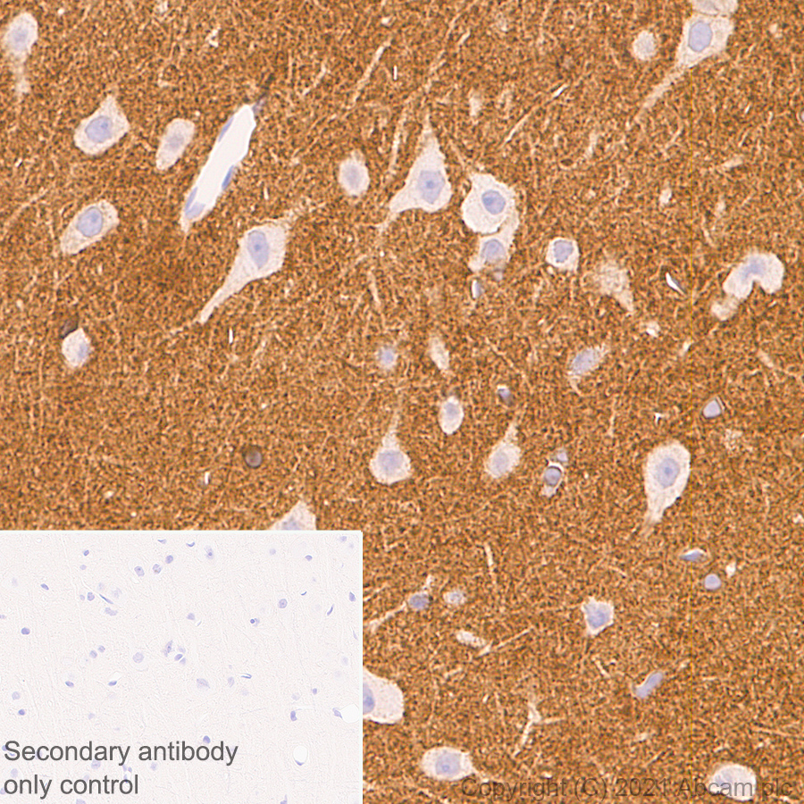 Immunohistochemistry (Formalin/PFA-fixed paraffin-embedded sections) - Anti-Metabotropic Glutamate Receptor 2 + 3 / MGLUR2 + MGLUR3 antibody [EPR24635-155] (ab281922), expandable thumbnail