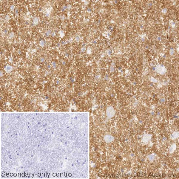 Immunohistochemistry (Formalin/PFA-fixed paraffin-embedded sections) - Anti-Metabotropic Glutamate Receptor 2 + 3 / MGLUR2 + MGLUR3 antibody [EPR24635-155] (AB281922)
