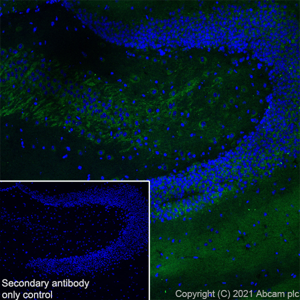 Immunohistochemistry (Frozen sections) - Anti-Metabotropic Glutamate Receptor 2 + 3 / MGLUR2 + MGLUR3 antibody [EPR24635-155] (ab281922), expandable thumbnail