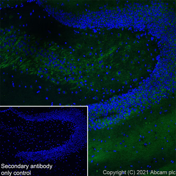 Immunohistochemistry (Frozen sections) - Anti-Metabotropic Glutamate Receptor 2 + 3 / MGLUR2 + MGLUR3 antibody [EPR24635-155] (AB281922)