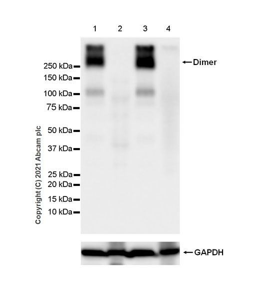 Western blot - Anti-Metabotropic Glutamate Receptor 2 + 3 / MGLUR2 + MGLUR3 antibody [EPR24635-155] (AB281922), expandable thumbnail