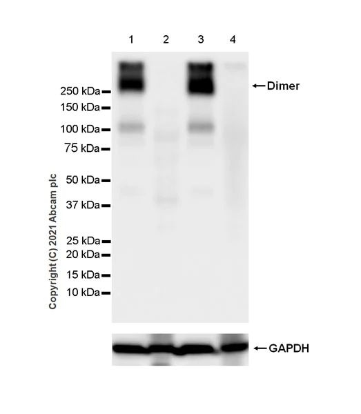 Western blot - Anti-Metabotropic Glutamate Receptor 2 + 3 / MGLUR2 + MGLUR3 antibody [EPR24635-155] (AB281922)
