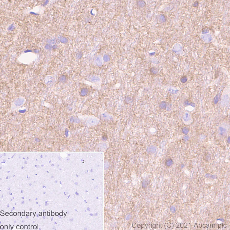 Immunohistochemistry (Formalin/PFA-fixed paraffin-embedded sections) - Anti-Metabotropic Glutamate Receptor 2 + 3 / MGLUR2 + MGLUR3 antibody [EPR8975] - BSA and Azide free (AB238432)