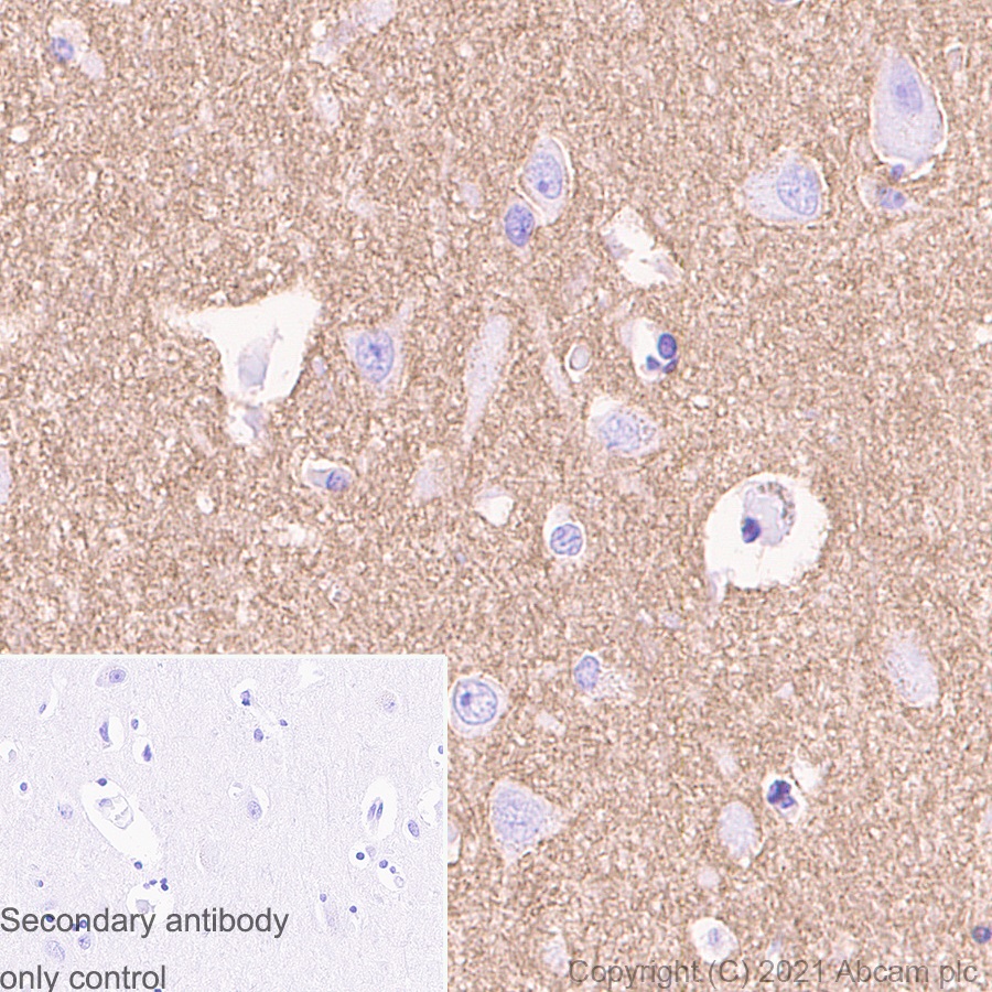 Immunohistochemistry (Formalin/PFA-fixed paraffin-embedded sections) - Anti-Metabotropic Glutamate Receptor 2 + 3 / MGLUR2 + MGLUR3 antibody [EPR8975] - BSA and Azide free (AB238432)