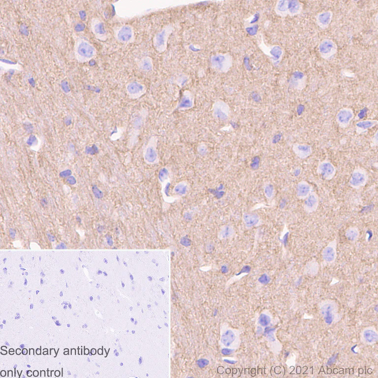 Immunohistochemistry (Formalin/PFA-fixed paraffin-embedded sections) - Anti-Metabotropic Glutamate Receptor 2 + 3 / MGLUR2 + MGLUR3 antibody [EPR8975] - BSA and Azide free (AB238432)