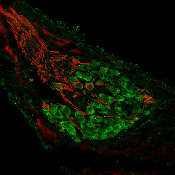 Immunohistochemistry (PFA perfusion fixed frozen sections) - Anti-Metabotropic Glutamate Receptor 2/MGLUR2 + Metabotropic Glutamate Receptor 3/MGLUR3 antibody (AB153670), expandable thumbnail