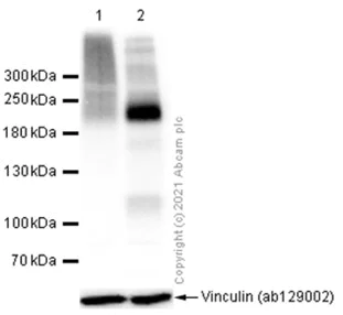Western blot - Anti-Metabotropic Glutamate Receptor 3/MGLUR3 antibody [EPR9009(2)] (AB166608)