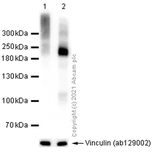 Western blot - Anti-Metabotropic Glutamate Receptor 3/MGLUR3 antibody [EPR9009(2)] (AB166608)