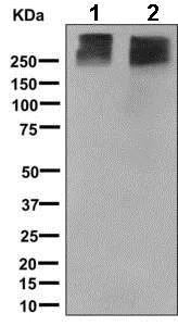 Western blot - Anti-Metabotropic Glutamate Receptor 3/MGLUR3 antibody [EPR9009(2)] (AB166608)