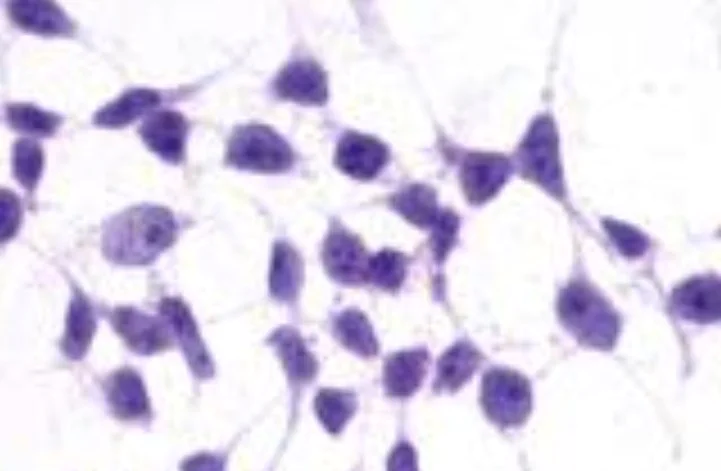 Immunocytochemistry/ Immunofluorescence - Anti-Metabotropic Glutamate Receptor 3/MGLUR3 antibody - N-terminal (AB188750)