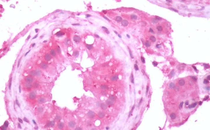 Immunohistochemistry (Formalin/PFA-fixed paraffin-embedded sections) - Anti-Metabotropic Glutamate Receptor 3/MGLUR3 antibody - N-terminal (AB188750)