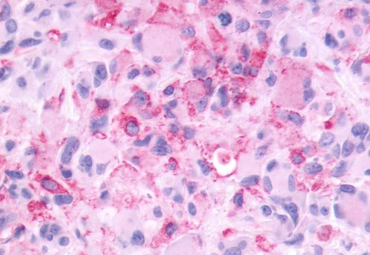 Immunohistochemistry (Formalin/PFA-fixed paraffin-embedded sections) - Anti-Metabotropic Glutamate Receptor 3/MGLUR3 antibody - N-terminal (AB188750)