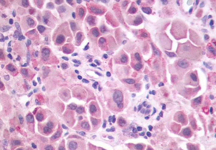 Immunohistochemistry (Formalin/PFA-fixed paraffin-embedded sections) - Anti-Metabotropic Glutamate Receptor 3/MGLUR3 antibody - N-terminal (AB188750)
