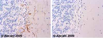 Anti-Metabotropic Glutamate Receptor 4/MGLUR4 antibody
