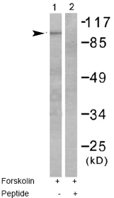 Western blot - Anti-Metabotropic Glutamate Receptor 4/MGLUR4 antibody (AB53088)