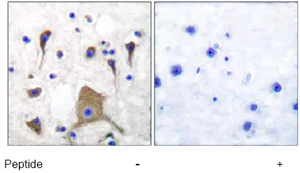 Immunohistochemistry (Formalin/PFA-fixed paraffin-embedded sections) - Anti-Metabotropic Glutamate Receptor 5 antibody (AB53090)