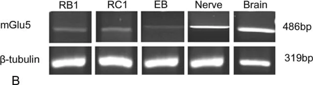 Western blot - Anti-Metabotropic Glutamate Receptor 5 antibody (AB53090)