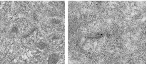 Electron Microscopy - Anti-Metabotropic Glutamate Receptor 5 antibody [EPR2425Y] (ab76316), expandable thumbnail