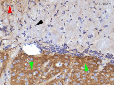 Immunohistochemistry (Formalin/PFA-fixed paraffin-embedded sections) - Anti-Metabotropic Glutamate Receptor 5 antibody [EPR2425Y] (ab76316), expandable thumbnail