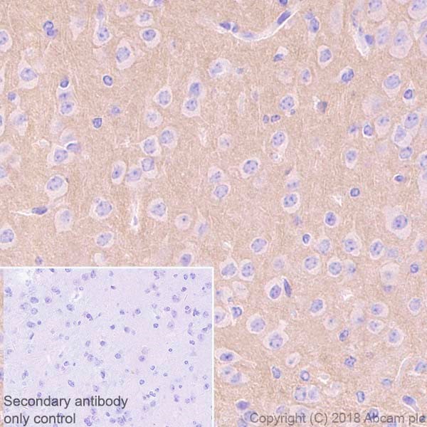 Immunohistochemistry (Formalin/PFA-fixed paraffin-embedded sections) - Anti-Metabotropic Glutamate Receptor 5 antibody [EPR2425Y] (AB76316), expandable thumbnail