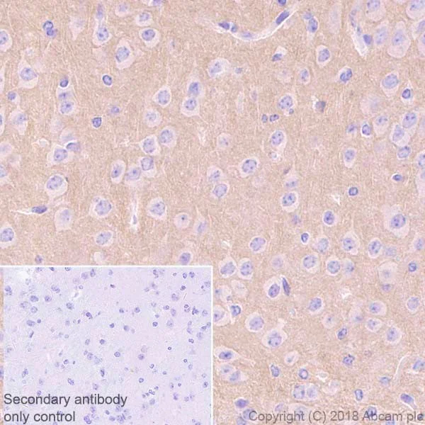 Immunohistochemistry (Formalin/PFA-fixed paraffin-embedded sections) - Anti-Metabotropic Glutamate Receptor 5 antibody [EPR2425Y] (AB76316)