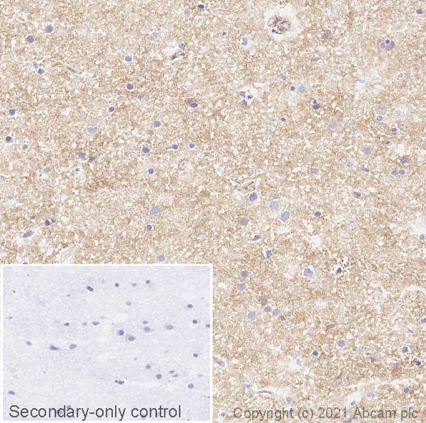 Immunohistochemistry (Frozen sections) - Anti-Metabotropic Glutamate Receptor 5 antibody [EPR2425Y] (AB76316), expandable thumbnail