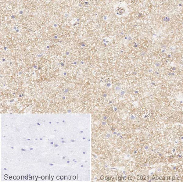 Immunohistochemistry (Frozen sections) - Anti-Metabotropic Glutamate Receptor 5 antibody [EPR2425Y] (AB76316)