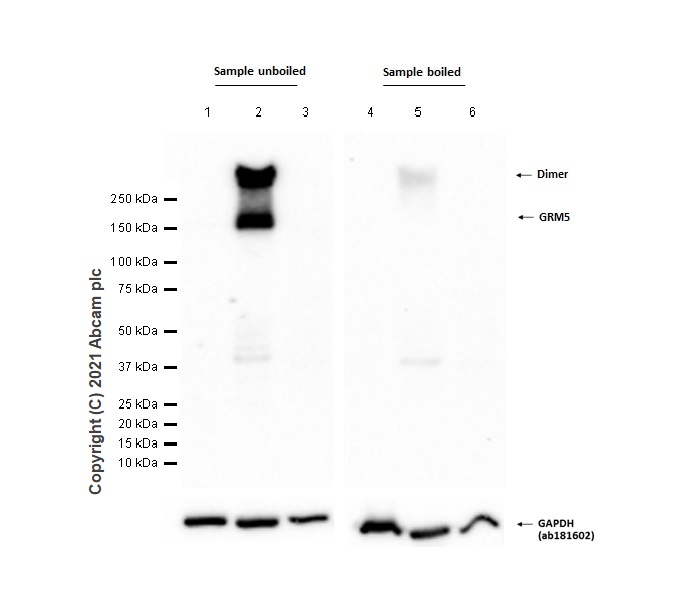 Western blot - Anti-Metabotropic Glutamate Receptor 5 antibody [EPR2425Y] (AB76316), expandable thumbnail