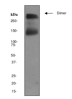 Western blot - Anti-Metabotropic Glutamate Receptor 5 antibody [EPR2425Y] (AB76316), expandable thumbnail
